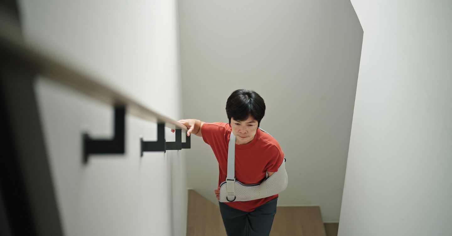 a woman walking up stairs with a sling for fractured bone treatment