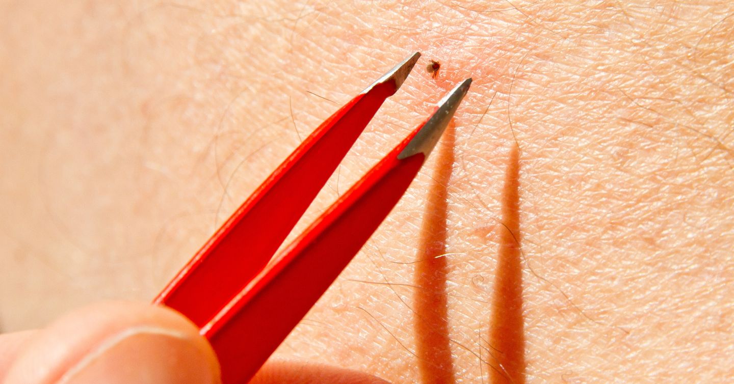 a person using tweezers to remove a tick